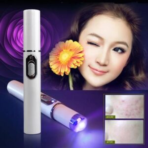 Home Caneta Luz Azul Anti-Acne — Terapia LED para Espinhas
